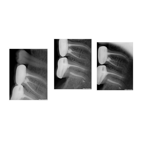 Rextar x dispositivos de rayos X de portal de punto focal de 0,8mm, El tamaño del punto focal es muy importante en cualquier radiografía. d